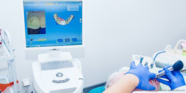 CEREC